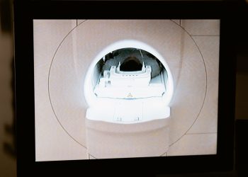 Close-up of an MRI scanner displayed on a monitor in a medical clinic.