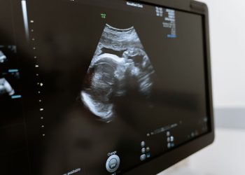 Close-up of an ultrasound showing a fetus on a monitor in a medical clinic.