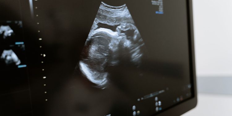 Close-up of an ultrasound showing a fetus on a monitor in a medical clinic.