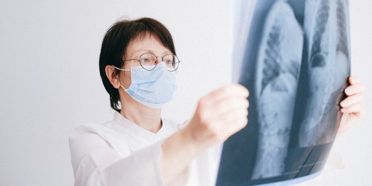 Doctor analyzes lung x-ray wearing a mask in a clinical setting.