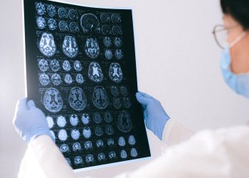 A medical professional reviewing MRI brain scans in a clinical setting, highlighting healthcare technology.