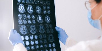 A medical professional reviewing MRI brain scans in a clinical setting, highlighting healthcare technology.